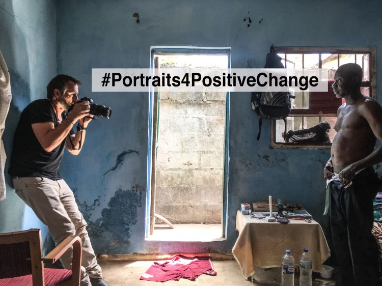 Jason Florio photographs Ballo Kanteh - an ex-political prisoner, he shows the burns he suffered after melted plastic was dripped onto his skin by Jammeh's hit-squad, the Junglers. Kanteh spent 18-year detention at the notorious Mile 2 prison - for the first two years, he was held in solitary confinement in a pitch dark cell, which has permanently damaged his eyesight. Image © Helen Jones-Florio 