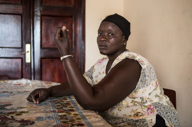 Oumie Jagne was shot twice in the arm by Gambian security forces during a peacful protests by students on April 10th 2000 © Jason Florio Gambia