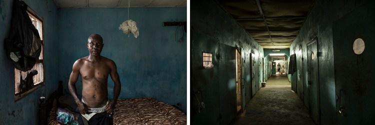 CAP PRIZE 2021 SHORTLIST: Ballo Kanteh, an ex-political prisoner shows the burns he suffered after melted plastic was dripped onto his skin by Jammeh's hit-squad, the Junglers. Kanteh spent 18-year detention at Mile 2 prison . Images ©Jason Florio/Helen Jones-Florio